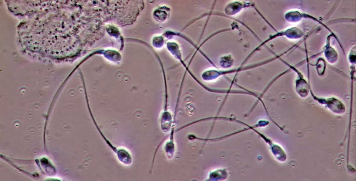 Air pollution affecting ability of sperms to swim in right direction