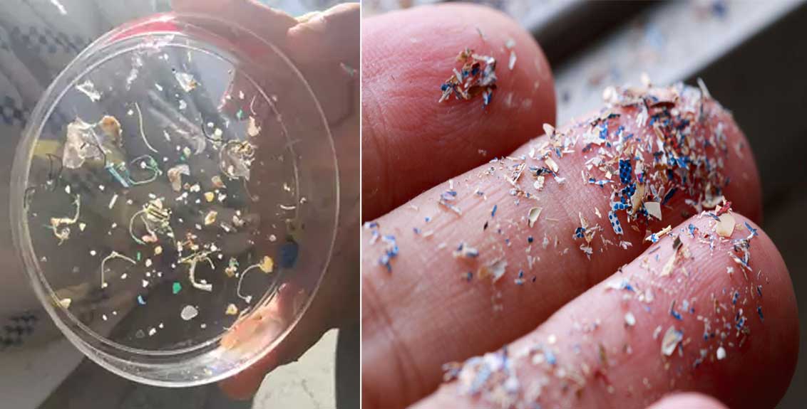 Microplastics Found In Human Blood For First Time Particles Can Travel Around The Body