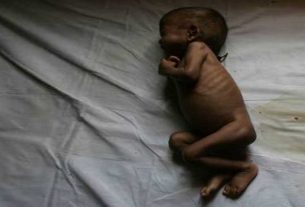 6,852 children died in Maharashtra due to malnutrition in the last three years