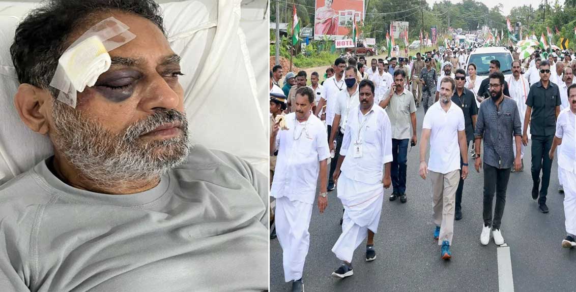 Congress leader and former Energy Minister Nitin Raut admitted to Hospital in Hyderabad